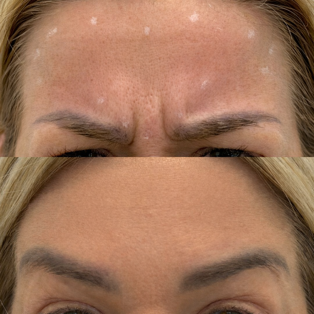 Medycyna estetyczna - przykład zabiegu 8